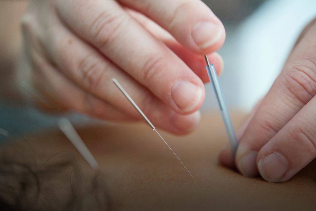 St. Albert Chiropractor Riverview Chiropractic Clinic